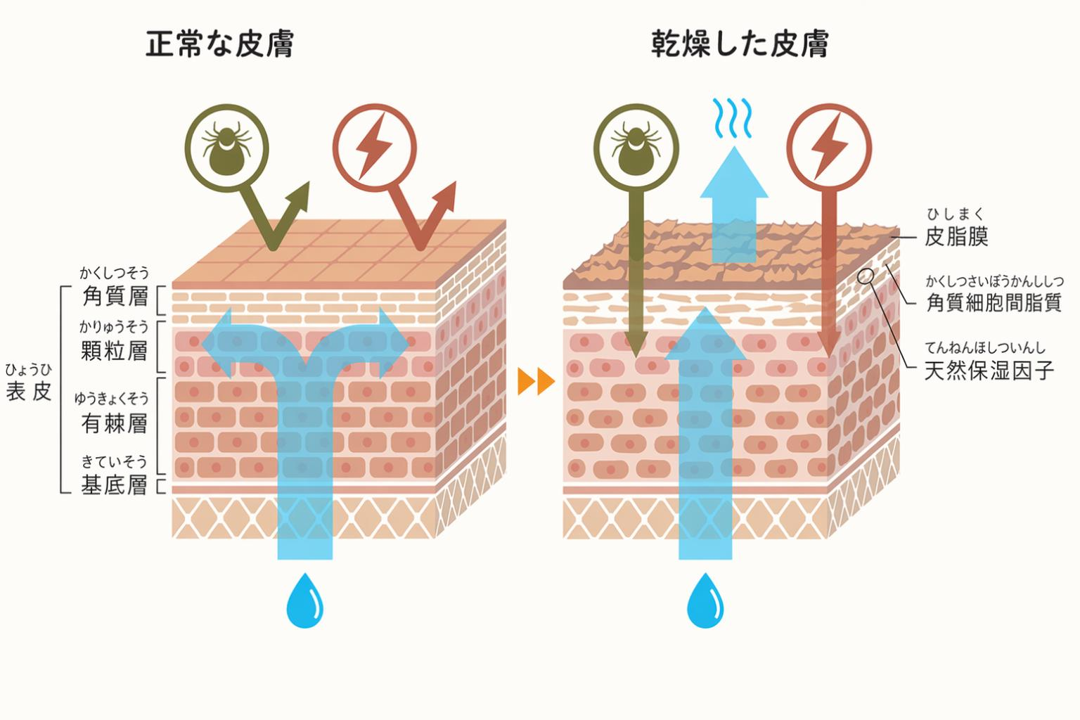 小児の皮膚：正常な皮膚と乾燥した皮膚のイメージ図